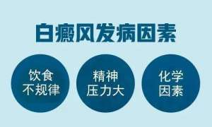 [十大排名]上海白癜风专科那家比较好-白癜风正常治疗多久才能好